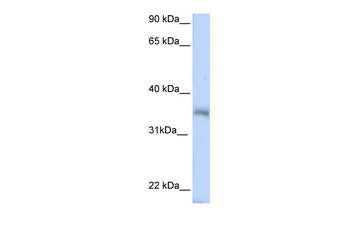 HEXIM2 Rabbit Polyclonal Antibody