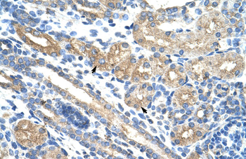 RPUSD2 Rabbit Polyclonal Antibody
