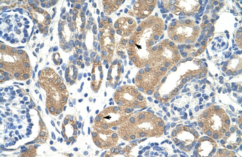 APOBEC3D Rabbit Polyclonal Antibody