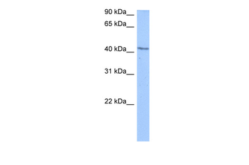 DCP2 Rabbit Polyclonal Antibody