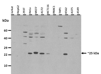 RBM24 Rabbit Polyclonal Antibody