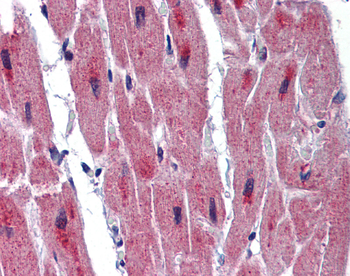 RBM24 Rabbit Polyclonal Antibody