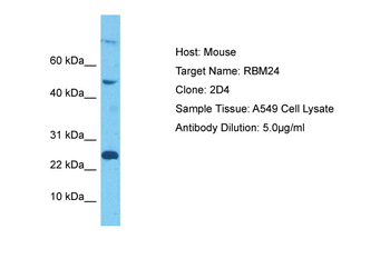RBM24 Rabbit Polyclonal Antibody