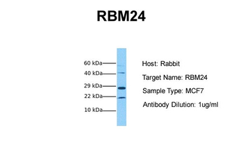 RBM24 Rabbit Polyclonal Antibody