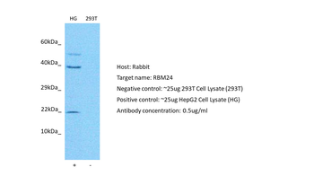 RBM24 Rabbit Polyclonal Antibody