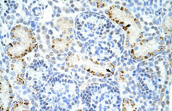 DAZAP1 Rabbit Polyclonal Antibody
