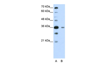 DAZAP1 Rabbit Polyclonal Antibody
