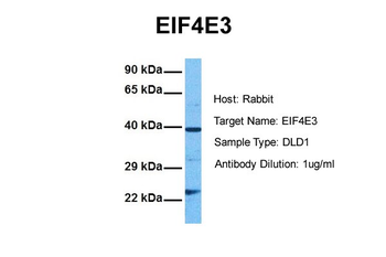 EIF4E3 Rabbit Polyclonal Antibody