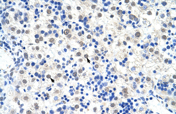 DDX47 Rabbit Polyclonal Antibody