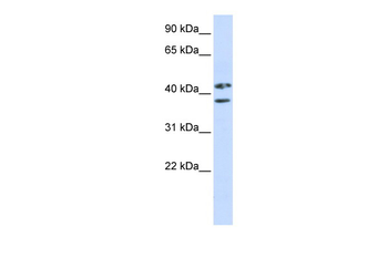 ZRANB2 Rabbit Polyclonal Antibody