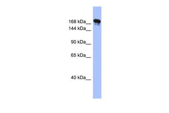 SYNJ1 Rabbit Polyclonal Antibody