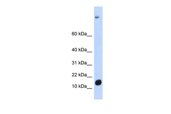 C6orf201 Rabbit Polyclonal Antibody