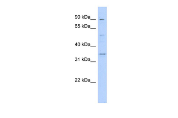 WNT9B Rabbit Polyclonal Antibody