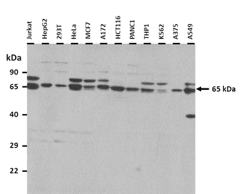 FZD5 Rabbit Polyclonal Antibody