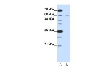 FZD5 Rabbit Polyclonal Antibody