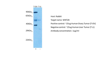 WNT2B Rabbit Polyclonal Antibody