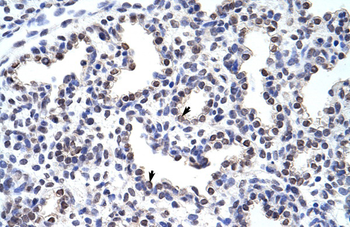 WNT2B Rabbit Polyclonal Antibody