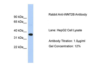 WNT2B Rabbit Polyclonal Antibody