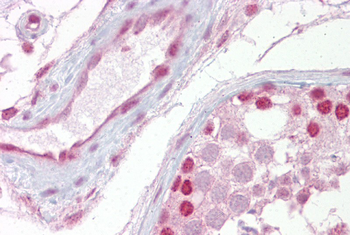 WNT2B Rabbit Polyclonal Antibody