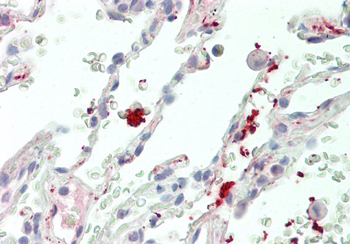 Wnt11 Rabbit Polyclonal Antibody