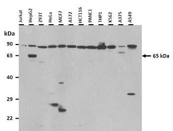FZD10 Rabbit Polyclonal Antibody