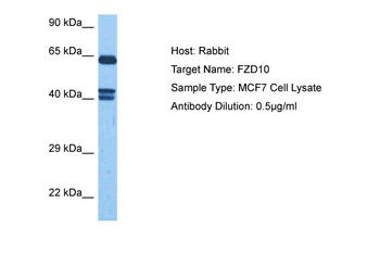 FZD10 Rabbit Polyclonal Antibody