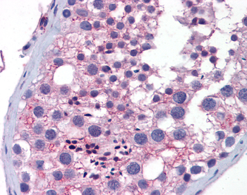 Wnt10a Rabbit Polyclonal Antibody