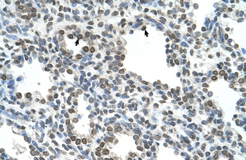 NKD1 Rabbit Polyclonal Antibody