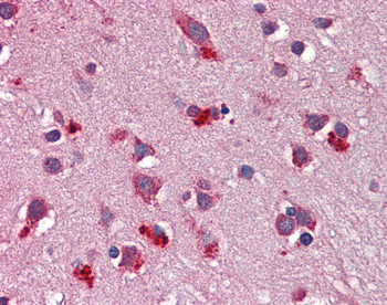WNT7B Rabbit Polyclonal Antibody