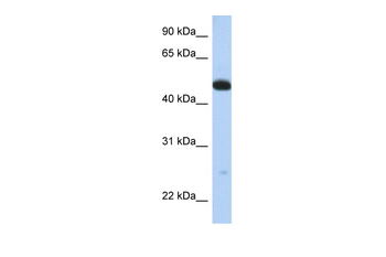WDR1 Rabbit Polyclonal Antibody