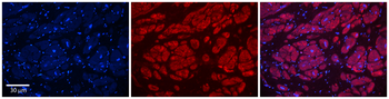 PIWIL1 Rabbit Polyclonal Antibody
