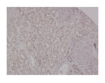 MSH2 Rabbit Polyclonal Antibody