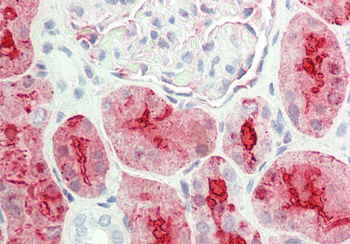 ALDOB Rabbit Polyclonal Antibody
