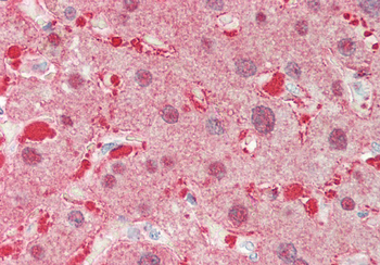ALDOB Rabbit Polyclonal Antibody