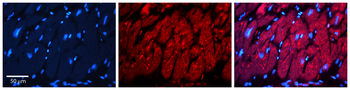 INSR Rabbit Polyclonal Antibody