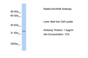 KHK Rabbit Polyclonal Antibody