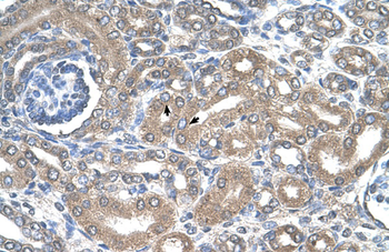 SLC12A1 Rabbit Polyclonal Antibody