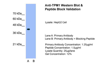 TPM1 Rabbit Polyclonal Antibody