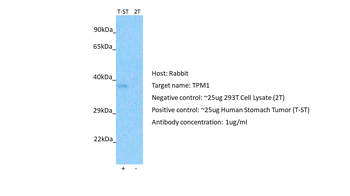 TPM1 Rabbit Polyclonal Antibody