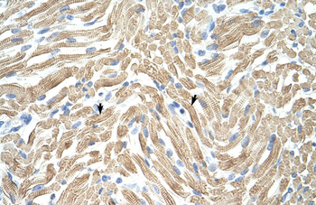 TPM1 Rabbit Polyclonal Antibody