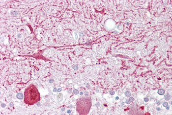 PON1 Rabbit Polyclonal Antibody