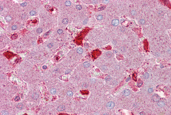 SERPINC1 Rabbit Polyclonal Antibody