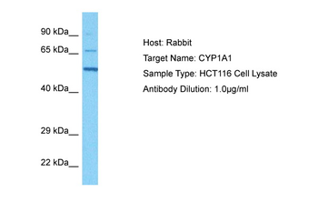 CYP1A1 Rabbit Polyclonal Antibody