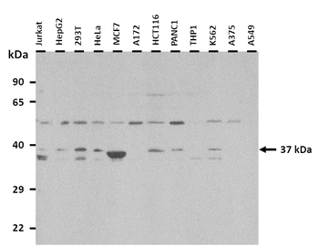 FBP1 Rabbit Polyclonal Antibody