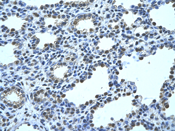 FBP1 Rabbit Polyclonal Antibody