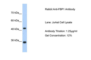FBP1 Rabbit Polyclonal Antibody