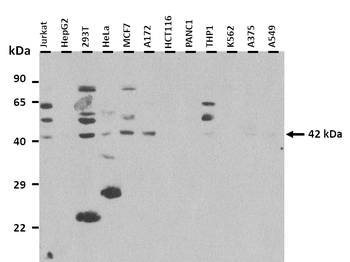 SFTPB Rabbit Polyclonal Antibody