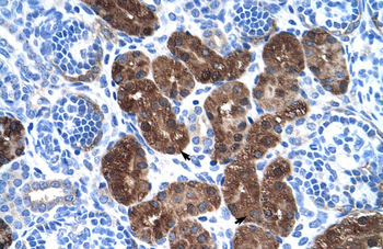 DDC Rabbit Polyclonal Antibody