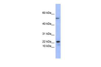 PLA2G5 Rabbit Polyclonal Antibody