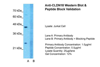 CLDN18 Rabbit Polyclonal Antibody